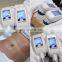 cryo lipolysis machine fat freezing  body slimming 4 handles work double chin beauty equipment