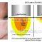 Skin Resurfacing Acne Scar Removal Treatment CO2 Multifunctional Fractional Laser Machine POP IPL FC10