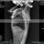 MY-W004B Vet x Ray Machine Analogue or Digital Radiography System Veterinary Medical X-ray Equipments