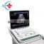 HC-A006B Laptop ultrasound machine portable ultrasound scanner ARM system