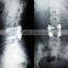 Waterproof medical film from china for hospital