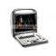 Sonoscape S8 portable color doppler ultrasound scanner sonoscape ultrasound machine S8
