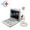 HC-A002  super popular hospital medical equipment ultrasound machine LED full digital ultrasound scanner