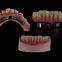 Dental-Implants china outsourcing dental lab