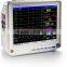 Hospital professional Equipment small size Patient Monitor device