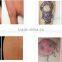 Q Switch Nd Yag Laser /laser 1500mj Tattoo Removal /nd Yag Long Pulse Laser Q Switch Laser Tattoo Removal