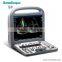 Medical device Color Doppler Portable 4d ultrasound