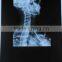 35*43cm Agfa films DT2B made in china for hospital agfa blue sensitive filmagfa x-ray film