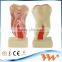 6 times anatomic profile model of mandibular molar for dental education