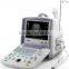 cancer medical equipment price of ecg machine ultrasound machine