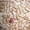 2015 GOOD light speckel kidney beansCHINA (HOT SALE)