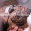 beauty machine dermatology tattoo removal q-switched alexandrite laser