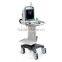 MC-DU-S2 Cheap 3D 4D Portable Color Doppler Ultrasound Scanner