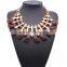Hot Korea Jewelry Collares de Moda 2015 French China