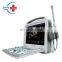 CE ISO High quality Portable color doppler ultrasound machine system/color doppler machines