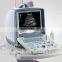 Laptop Doppler portable ultrasound machine price CE certified medical equipment used in hospital