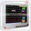 15 inch 6 Parameter ECG NIBP SPO2 TEMP RESP PR Patient Monitor RPM-9000E