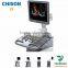 Mobile 4D color doppler ultrasound systme Chison trolley ultrasound