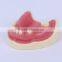 Trade Assurance Hot Dental Implant System CE Approved Dental Implant Model