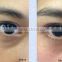RF face lift beauty machine for lighten black eye