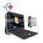 HC-A012F Ultrasound Scanner The Most Economical Portable Color Doppler Ultrasound Scanner color doppler ultrasound machine