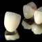 All-Ceramic FDA 3014652903 Zirconia Dental Crown Veneer Inlay Onlay