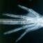 single film led medical film medical x-ray film