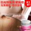 Afy Pregnancy Repairing Cream Stretch Mark Removal Postpartum Obesity Slack Line Potent Repair Scar