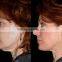 best rf skin tightening face lifting machine/fractional rf microneedle machine