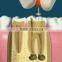 Let your tooth more strong surgical wireless dental endo motor reciprocating
