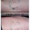 Telangiectasis Treatment 2016 Q-Switch ND: YAG Mongolian Spots Removal Laser Tattoo Removal Therapy Machine Permanent Tattoo Removal