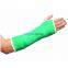 Medical Casting Tapes Fiberglass Cast Bandage CE FDA Polyester Casting Tapes