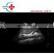 High quality black/white image Pregnancy ultrasound machine portable/Ultrasound machine price portable/Sonoscape e1