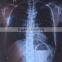 kodak medical x-ray film used in hospital x-ray thermal imaging camera Medical laser paper film