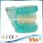 Popular Transparent Plastic Pathologic Dental Implant Model for study