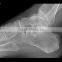 Konida fuji dry film medical x-ray film for sale