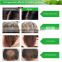 hair loss treatment best quality anti hair loss shampoo HOT SELLING shampoo prevent hair loss