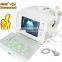 2016 Brand New Best Quality CE Approved Digital Portable Style Ultrasound Machine/Scanner For Sale with Cheap Price-Shelly