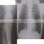 Konida imagers x ra blue sensitive films Medical thermal film china film