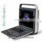 pc based ultrasound scanner portable ultrasound scanner usb ultrasound scanner