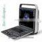 colour ultrasound scanner with report printing colour ultrasound scanner usb with report