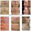 Professional Medical CE Approved Micro Needle Fractional Radio Frequency Machine / RF Wrinkle Removal Facial Massage Machine