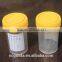 60ml male urine container with sterile
