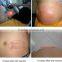 High Effeciency Body Sculpture and Contouring Slimming Beauty Machine