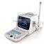 Portable PC platform 3D Ultrasound Scanner diagnosis of Abdomen Cardiac Gynecology Obstetrics Thyroid Gland Small Organs Urology