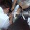 High Quality salon clinical machine q switched nd yag laser/laser yag remove tattoo