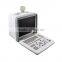 China Medical Ultrasonic Equipment pc based usb ultrasound scanner with cheap price