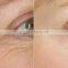 most popular Fractional radio frequency needle for wrinkle removal face lift/facial skin rejuvenation