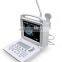 12.1 inch LED Display Portable Ultrasound Scanner Black and White Ultrasound Machine