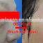 Top Sell !! Laser Co2 Fractional Skin Resurfacing 8.0 Inch Machine Laser Skin Treatment Machine CE Mole Removal